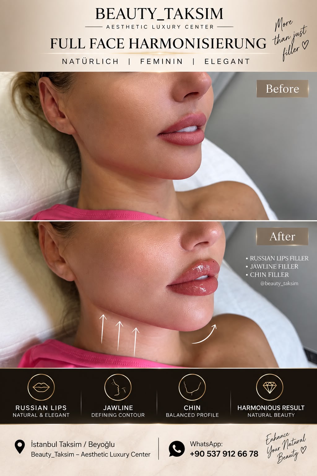 Treatment photo 14
