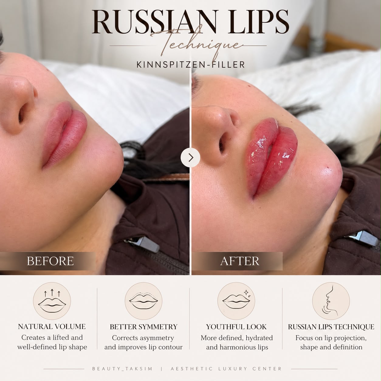 Treatment photo 20