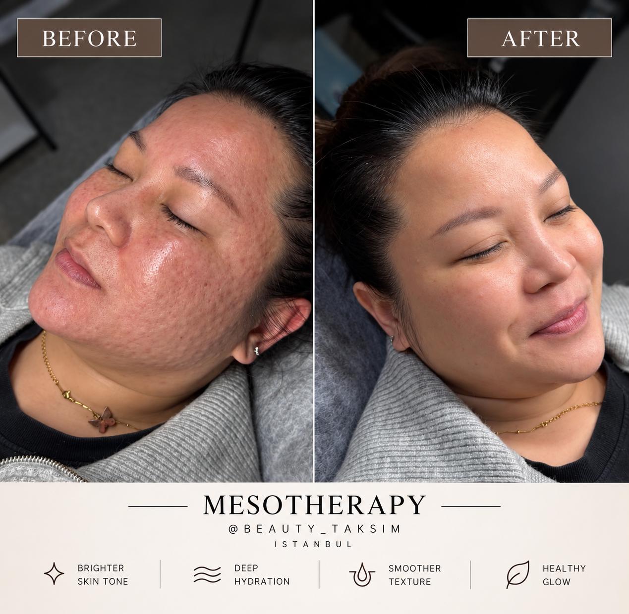 Treatment photo 5